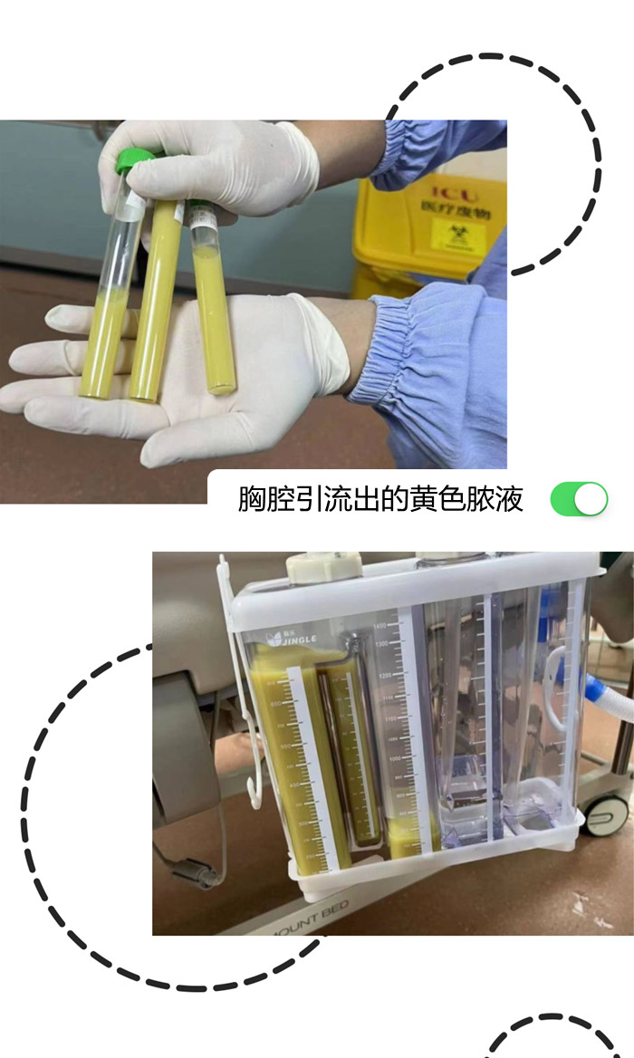 智齿1.jpg