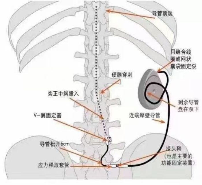 图片 1.jpg